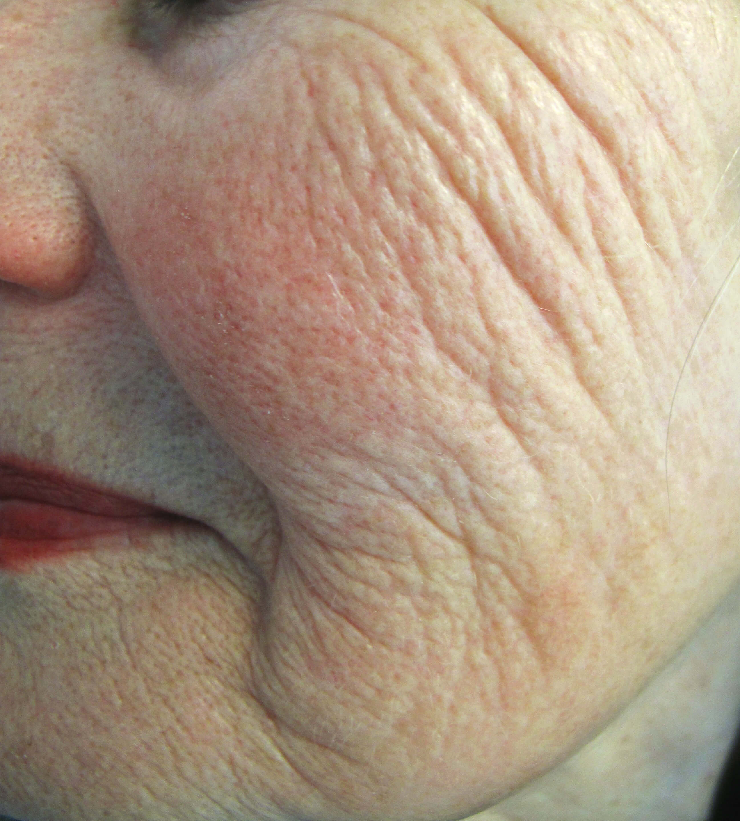 closeup of woman's face with wrinkles